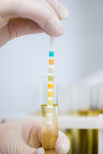 testing a feline urine sample for glucose in a case of suspected diabetes