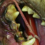priodontitis