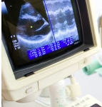 An echocardiogram (heart ultrasound) is often recommended to confirm a suspected diagnosis of Feline Hypertrophic Cardiomyopathy (HCM) and to determine how advanced the heart disease is.