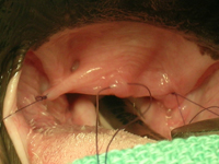 The beginning of the soft palate resection. Sutures are placed into the palate and used to retract the edge toward the surgeon and stabilise it during resection 