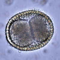 A roundworm egg viewed under a microscope