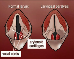 laryngeal paralysis