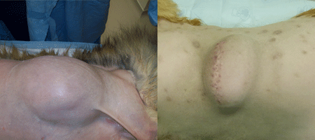 You can't judge by appearances! These images show 2 masses on chest walls with very similar appearance.  The lump on the left was a benign fatty mass and cured with simple surgery.  The lump on the right was an aggressive malignant tumour that required extensive surgery to treat it.