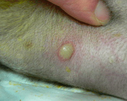 Fig 1: Photograph of a pustule - a common sign of a bacterial infection