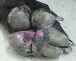 Fig 2: Photograph showing nodular lesions of a deep skin infection