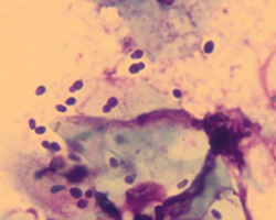 Fig 5: Peanut shaped Malassezia yeasts from the infected ear of a dog