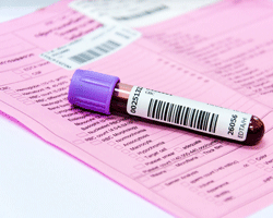 Blood samples are collected for pre-anaesthetic blood tests