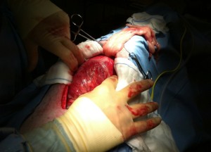 bloat surgery in the dog
