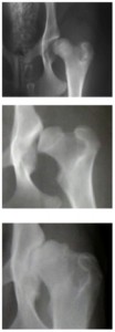 how dog hip dysplasia develops