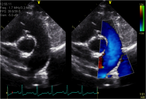 heart ultrasound in a dog