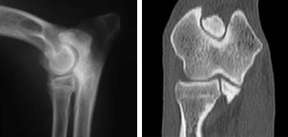 Elbow radiograph (left) and Elbow CT scan(right). These are important tests for detecting elbow dysplasia in dogs