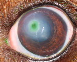 corneal ulcer