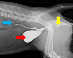 ectopic ureter, urinary incontinence