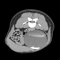 urinary incontinence, ectopic ureters