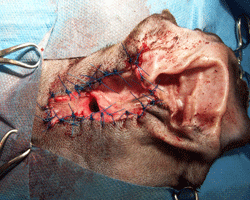 Fig 3: This dog has had a lateral wall resection ear surgery