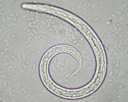 This image, taken under a microscope, shows a lungworm (Angiostrongylus vasorum) which was found in a dog’s faeces